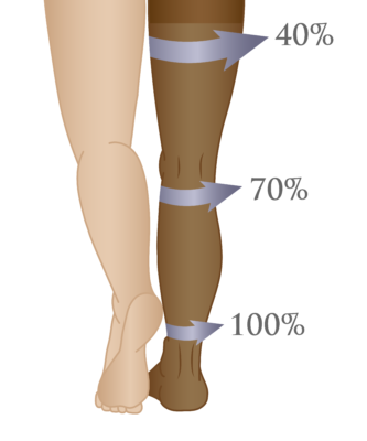 Gradient Compression Vary Levels-01