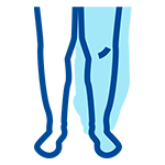 Lymphedema